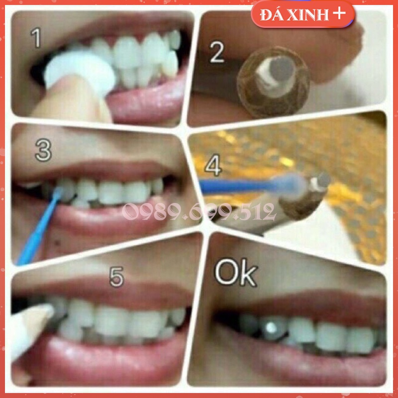 Đá Đính Răng Sáng Đẹp Lẻ đá đính răng không cần khoan răng