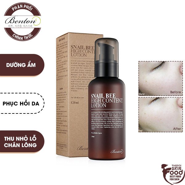 Sữa Dưỡng Ẩm Phục Hồi Da, Giúp Da Săn Chắc Chiết Xuất Ốc Sên Benton Snail High Content Lotion 120ml