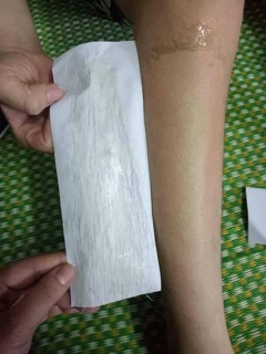 Combo triệt lông wax + mỡ trăn