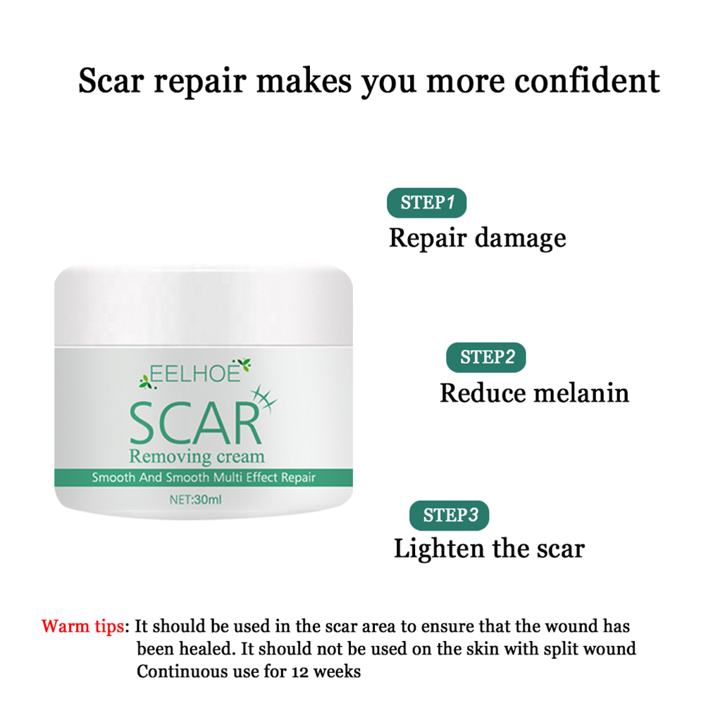 (Hàng Mới Về) Kem Trị Sẹo Và Vết Rạn Da 30ml Cao Cấp | BigBuy360 - bigbuy360.vn