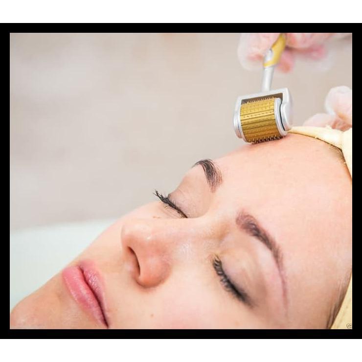 Kim Lăn Kim Titan 540 Kim Rhe5 Kim | BigBuy360 - bigbuy360.vn