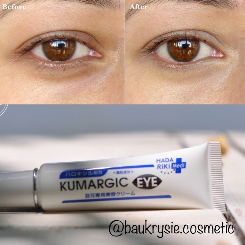 [Chính hãng Nhật] Kem Giảm Quầng Thâm Mắt Kumargic Eye