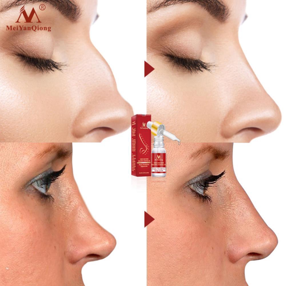 Tinh dầu nâng mũi làm đẹp thương hiệu MeiYanQiong | BigBuy360 - bigbuy360.vn