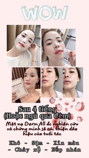 MẶT NẠ CAO CẤP DERM ALL MATRIX MẪU MỚI