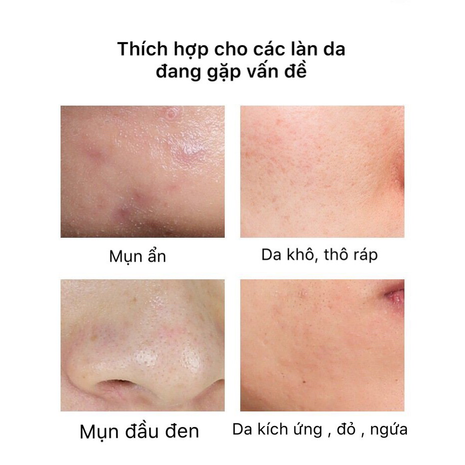 Nước hoa hồng BFACE SAMANLI  ngăn ngừa mụn ẩn se lỗ chân lông Rosemary Verbenone Hydrosol Verbena BFAC01 SAML04