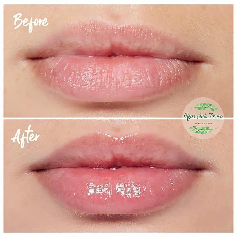 KEM DƯỠNG MÔI GIẢM THÂM VÀ XÓA NHĂN NEOVA CU3 INTENSIVE LIP REPAIR 14g