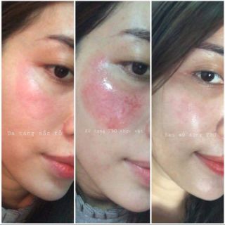 Tế bào thực vật siêu phục hồi da