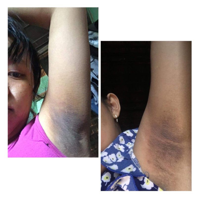 Kem loại bỏ thâm nách hôi nách Cô Bơ hủ nhỏ 8gr | BigBuy360 - bigbuy360.vn