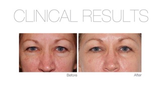 [DR. Dennis Gross] [Authentic] Miếng Peel Da Dr Dennis Alpha Beta Universal/Extra Strength Daily Peel