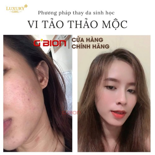 COMBO PEEL DA VI TẢO THẢO MỘC LUXURY GIRL, NPP GBION