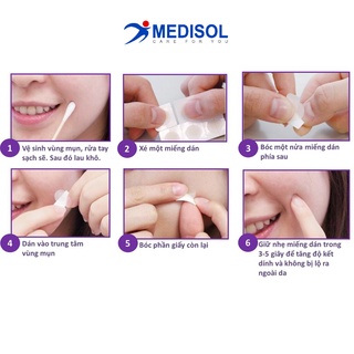 Miếng Dán Mụn - Neoderm Ultra Thin Spot 48 (hộp 1 size, 48 miếng)