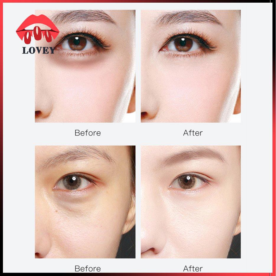 [Hàng mới về] Hộp 60 Miếng Mặt Nạ Mắt Collagen Ngọc Trai Đen Tự Nhiên Dưỡng Ẩm Xóa Quầng Thâm Chống Lão Hóa Hiệu Quả