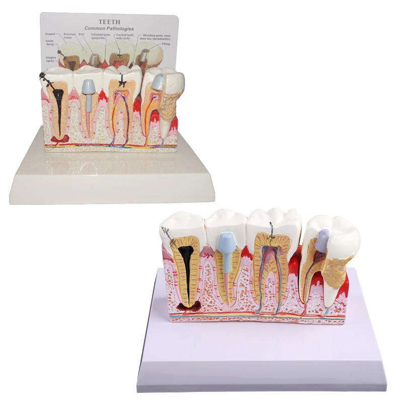 Mô Hình Răng Giả 7x5.9x5.1inches Dùng Trong Học Tập