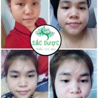 Sắc dược sang sang