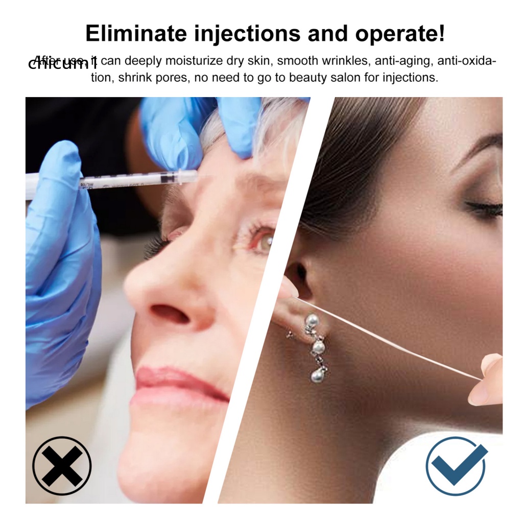 Cuộn Chỉ Collagen Mini Chống Lão Hóa Chăm Sóc Da Mặt Sử Dụng Tại Nhà