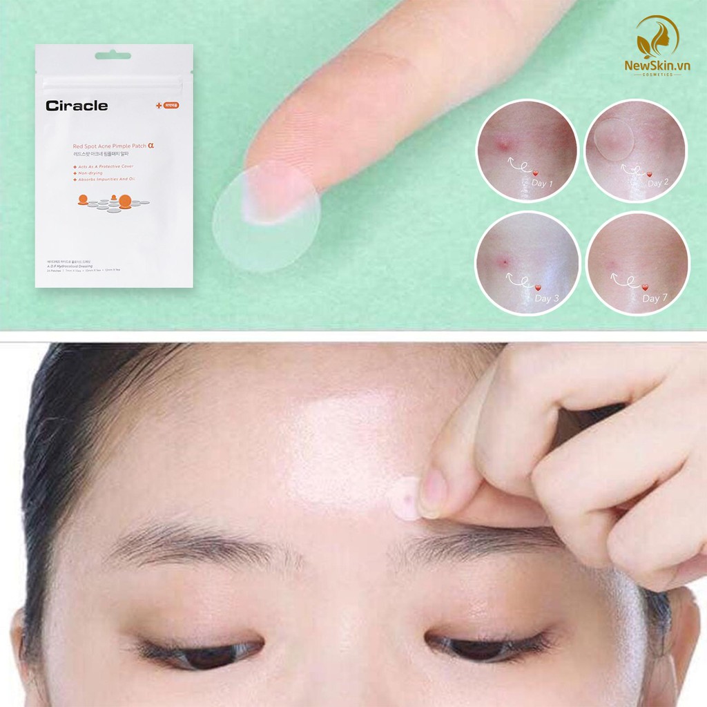 Miếng Dán Mụn Ciracle Red Spot Acne Pimple Patch