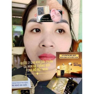Ủ yến thải độc Magicskin
