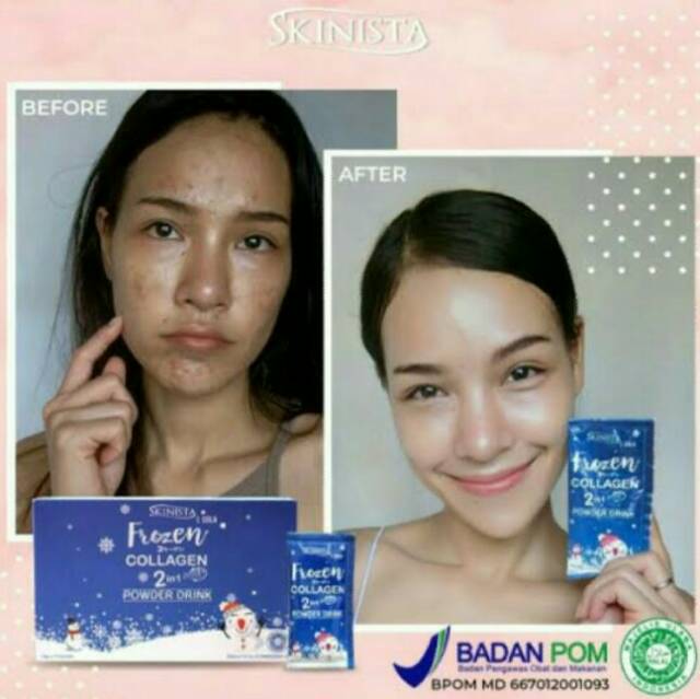 (hàng Mới Về) Bột Collagen 2 Trong 1 Skinista Frozen