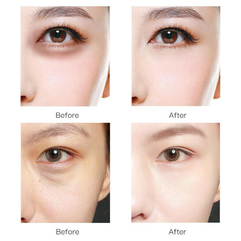 Set 60 Miếng Mặt Nạ Mắt Images Chứa Collagen Và Vitamin C Dưỡng Ẩm Ngừa Nếp Nhăn Và Loại Bỏ Quầng Thâm Hiệu Quả | BigBuy360 - bigbuy360.vn