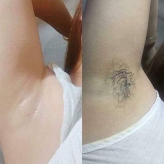 Kem Tẩy lông Kone thái Hiệu quả
