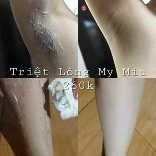 Triệt lông My Miu.