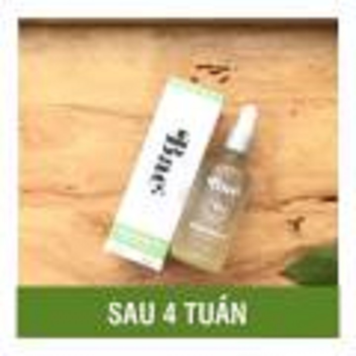 Tinh dầu chống rạn da Bae | BigBuy360 - bigbuy360.vn