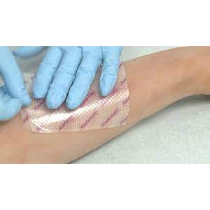 Tấm lưới silicone bảo vệ vết thương Mepitel One