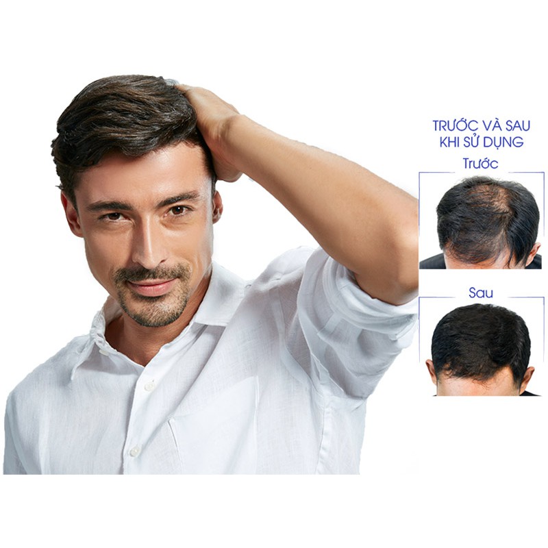 QIK HAIR - Cải thiện tình trạng rụng tóc cho cả nam và nữ, Ngăn ngừa tình trạng rụng tóc, hói đầu (Lọ 30 viên)