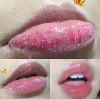 Vaseline dưỡng môi (7g)