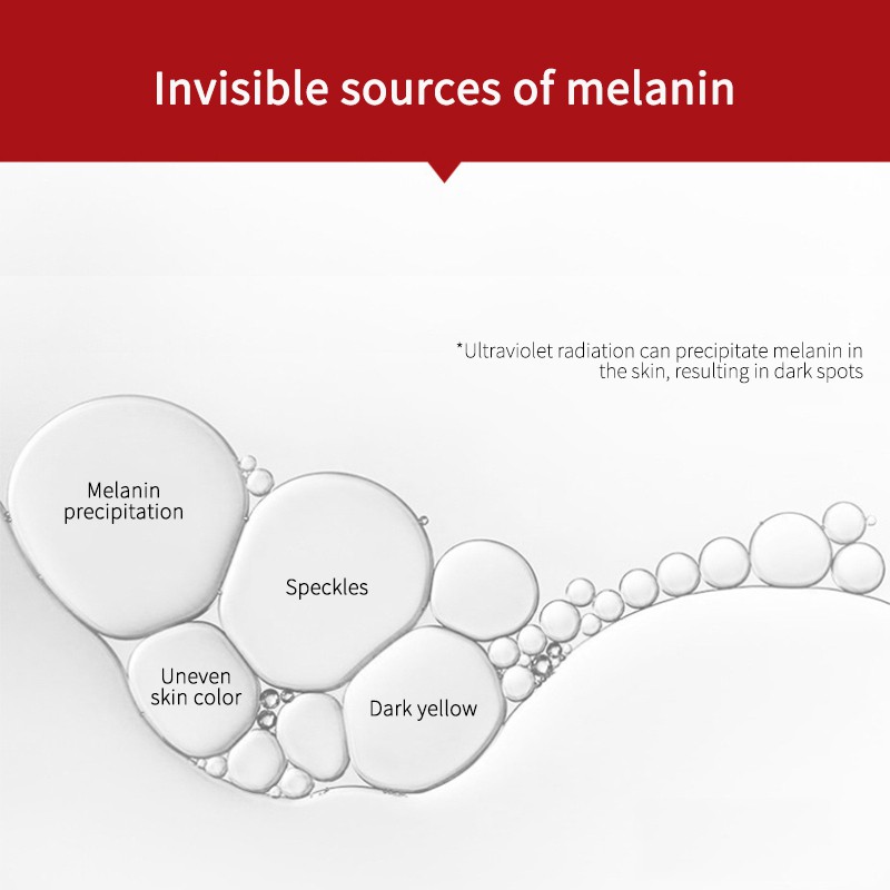 (Hàng Mới Về) Kem Trị Tàn Nhang Làm Trắng Sáng Da 20g | BigBuy360 - bigbuy360.vn