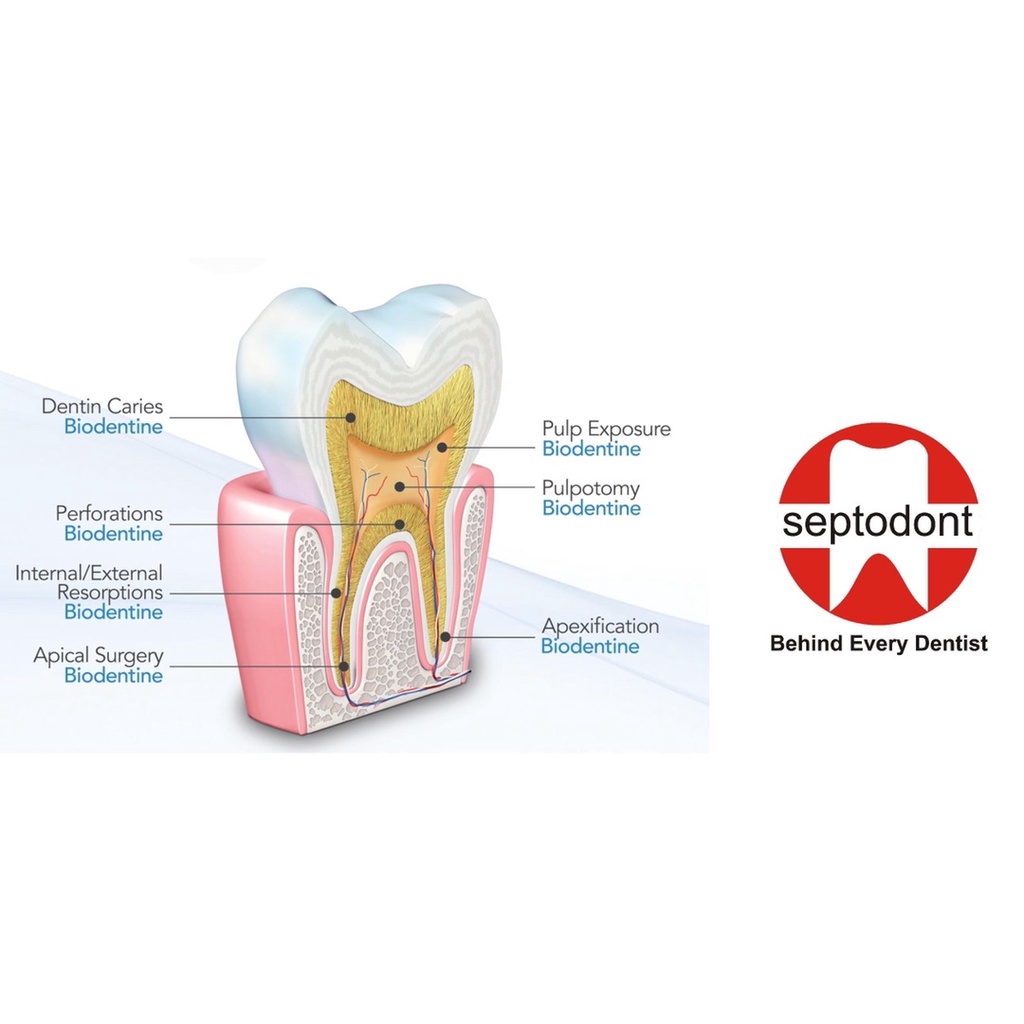 BIODENTINE Vật liệu sinh học thay thế ngà