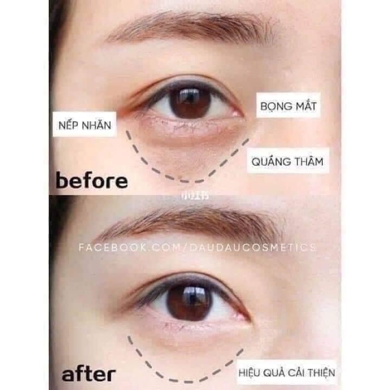 kem mắt Whoo vàng dưỡng ẩm chống lão hoá mờ thâm tan bọng mắt 1ml intensive Nutritive eye cream