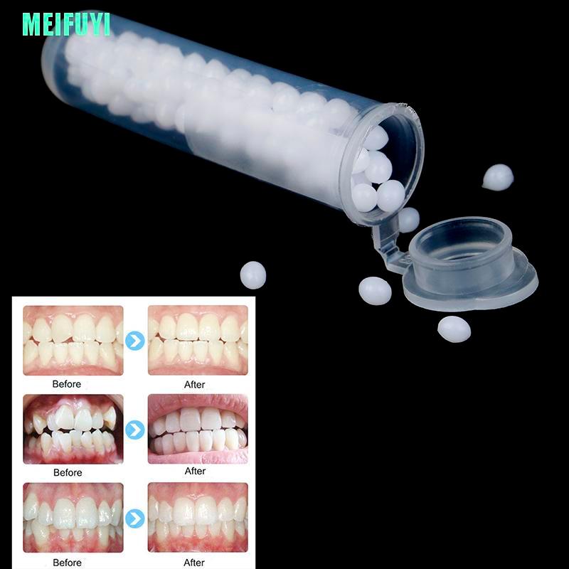 (Hàng Mới Về) Bộ 1 Tuýp Keo Dán Răng Giả 10g Chất Lượng Cao