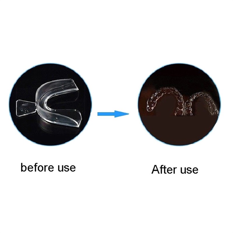 Dụng Cụ Bảo Vệ Răng Ban Đêm Bằng Silicone