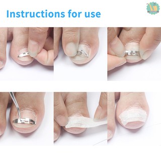 Bộ 3 Dụng Cụ Điều Chỉnh Hình Dáng Móng Chân