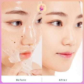 HỘP 20 GÓI Peel sạch sừng già, làm thoáng lỗ chân lông da mượt mà tươi mới  trắng sáng WINKBEAUTY