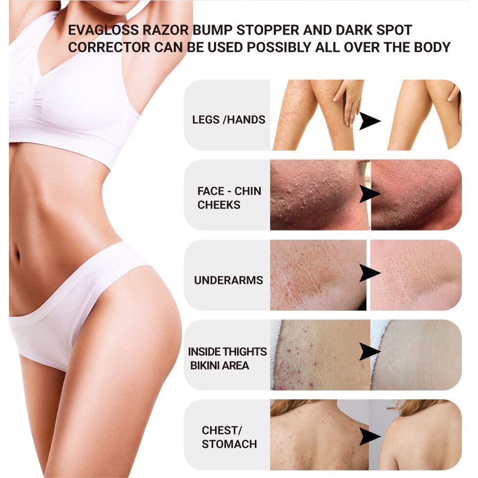 SERUM LĂN NGỪA LÔNG MỌC NGƯỢC SƯNG ĐỎ NGỨA KÍCH ỨNG NANG LÔNG