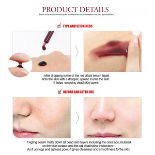 THAY DA SINH HỌC RED PEEL HÀN QUỐC 35ml