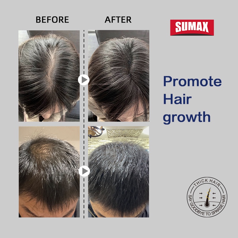 Dầu gội SUMAX chống rụng tóc chiết xuất gừng thích hợp đi du lịch 50ml