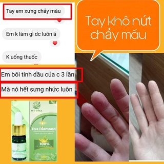 Tinh Dầu Đa Năng Evadiamond (Hỗ Trợ Các Vấn Đề Về Răng Miệng)