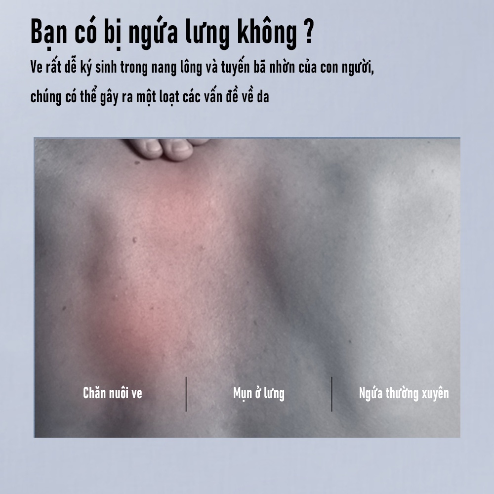 Sữa Tắm Nam Blueman Hương Nước Hoa Thơm Lâu Anti Acne Giảm Mụn Lưng Mờ Thâm 500ml