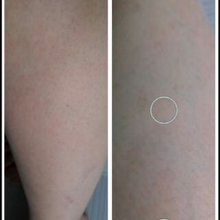 Mỡ trăn nguyên chất 100ml.