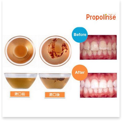 [Mã giảm giá mỹ phẩm chính hãng] Nước súc miệng của Nhật Bản Propolinse Chính hãng