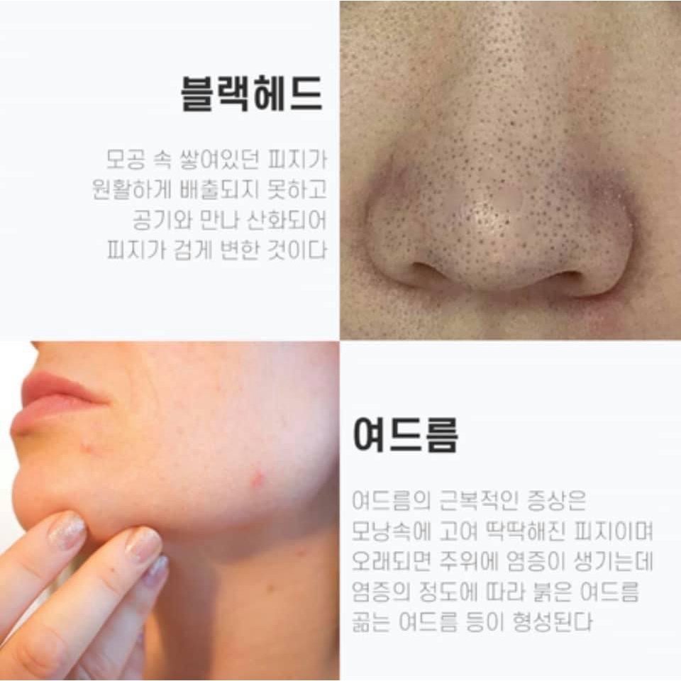 Set dưỡng serum+lotion DR&CO cho da mụn