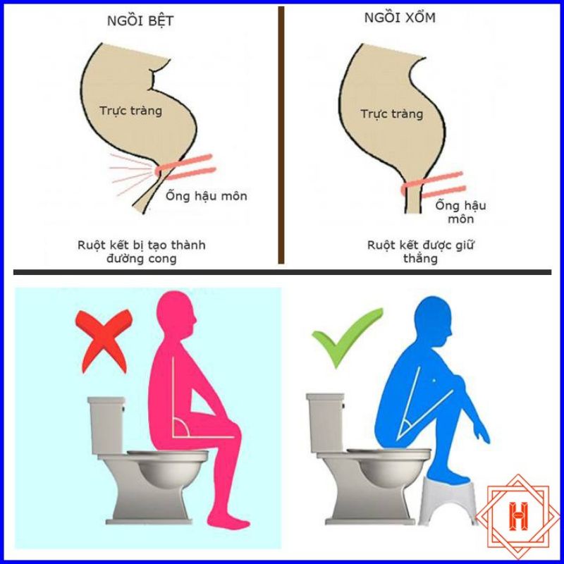Ghế kê chân toilet chống táo bón Song Anh