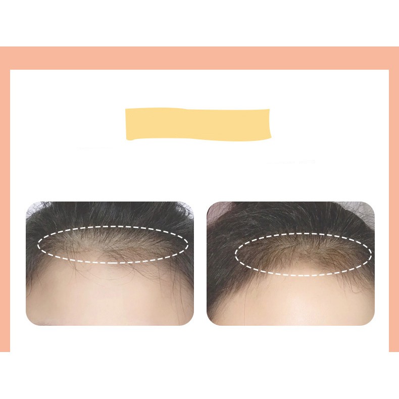 Phấn Phủ Chân Tóc Tạo Dày Kiểu Tóc Xixi Hairline | BigBuy360 - bigbuy360.vn