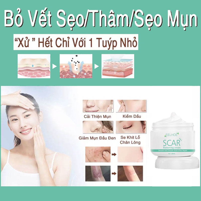 EELHOE Gel xóa sẹo Loại bỏ Sẹo mụn, Vết rạn da và Sẹo lồi Sửa chữa da