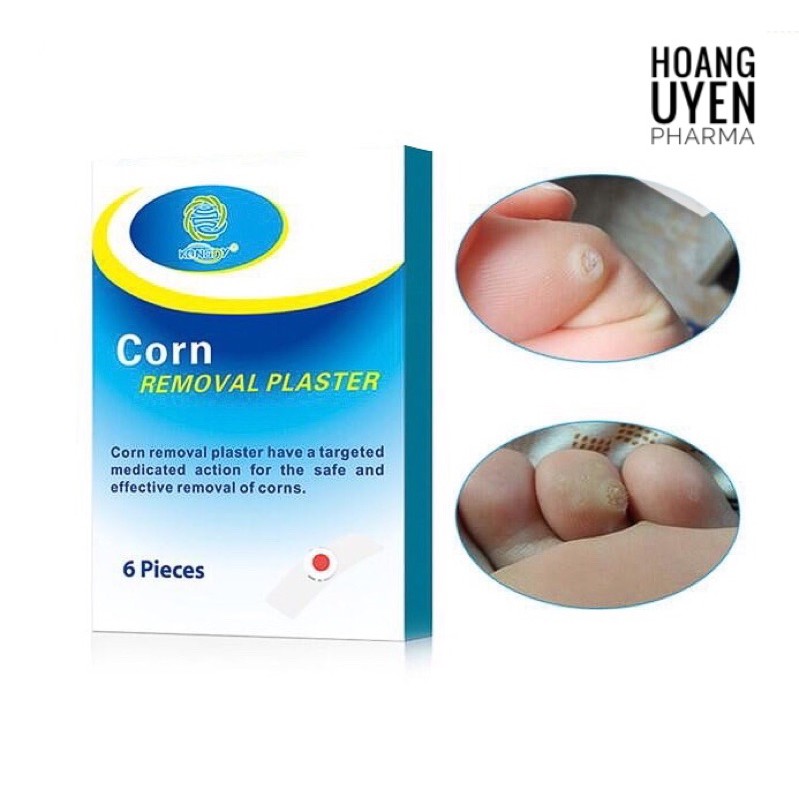 Miếng dán mụn cóc Corn removal plaster - Hộp 6 miếng