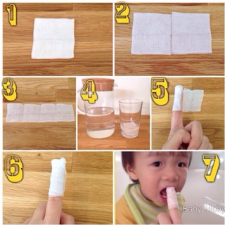 Gạc rơ lưỡi cho trẻ sơ sinh MOBY