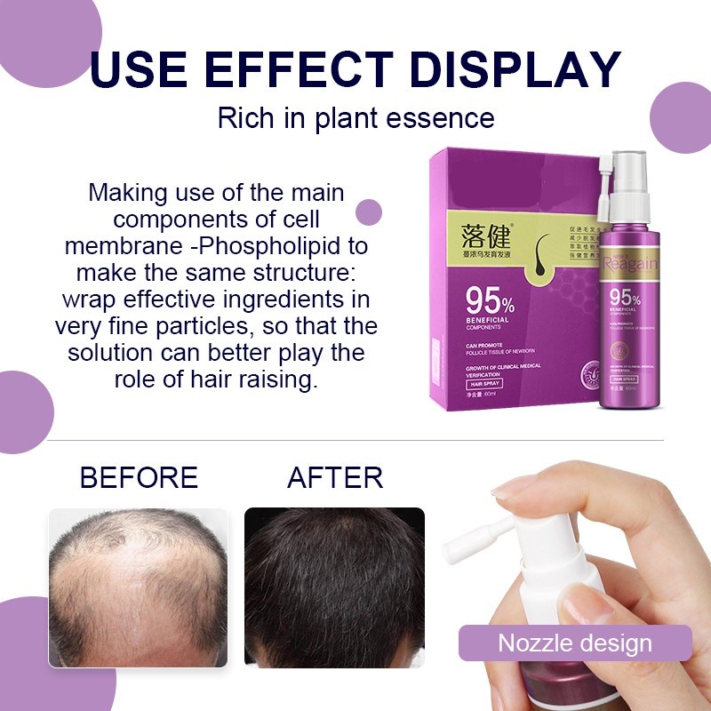 Serum mọc tóc cho phụ nữ SUMAX 60ML